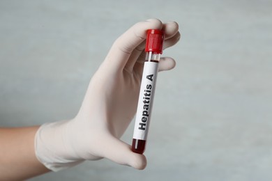 Scientist holding tube with blood sample and label Hepatitis A on light background, closeup