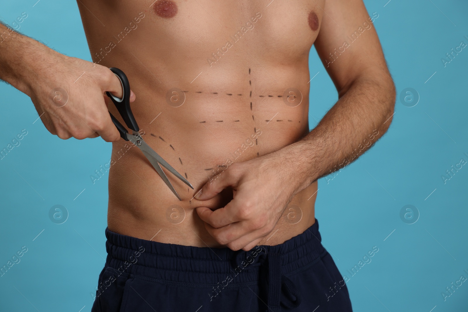 Photo of Fit man with scissors and marks on body against light blue background, closeup. Weight loss surgery