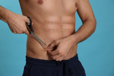 Photo of Fit man with scissors and marks on body against light blue background, closeup. Weight loss surgery