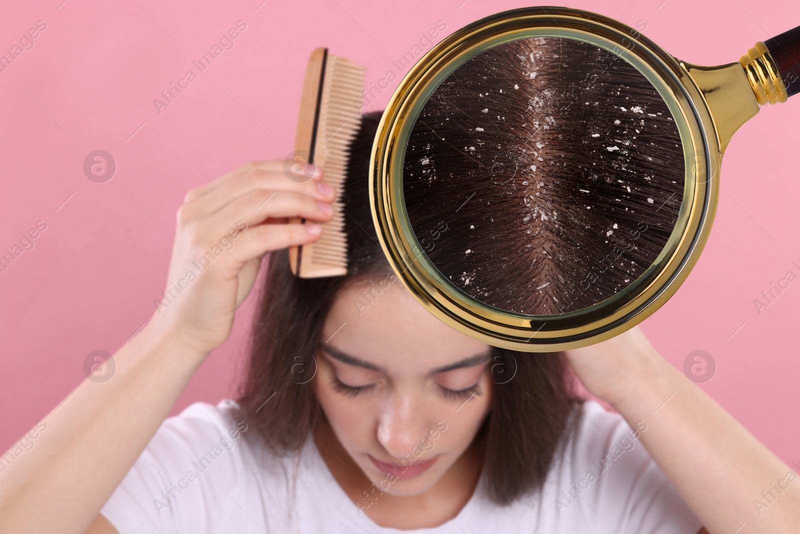 Image of Woman suffering from dandruff on pink background. View through magnifying glass on hair with flakes