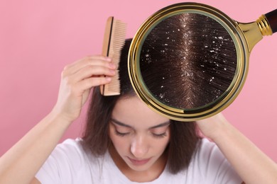 Woman suffering from dandruff on pink background. View through magnifying glass on hair with flakes