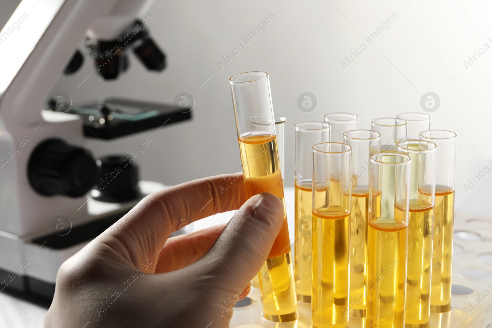 Photo of Nurse holding tube with urine sample for analysis in laboratory, closeup