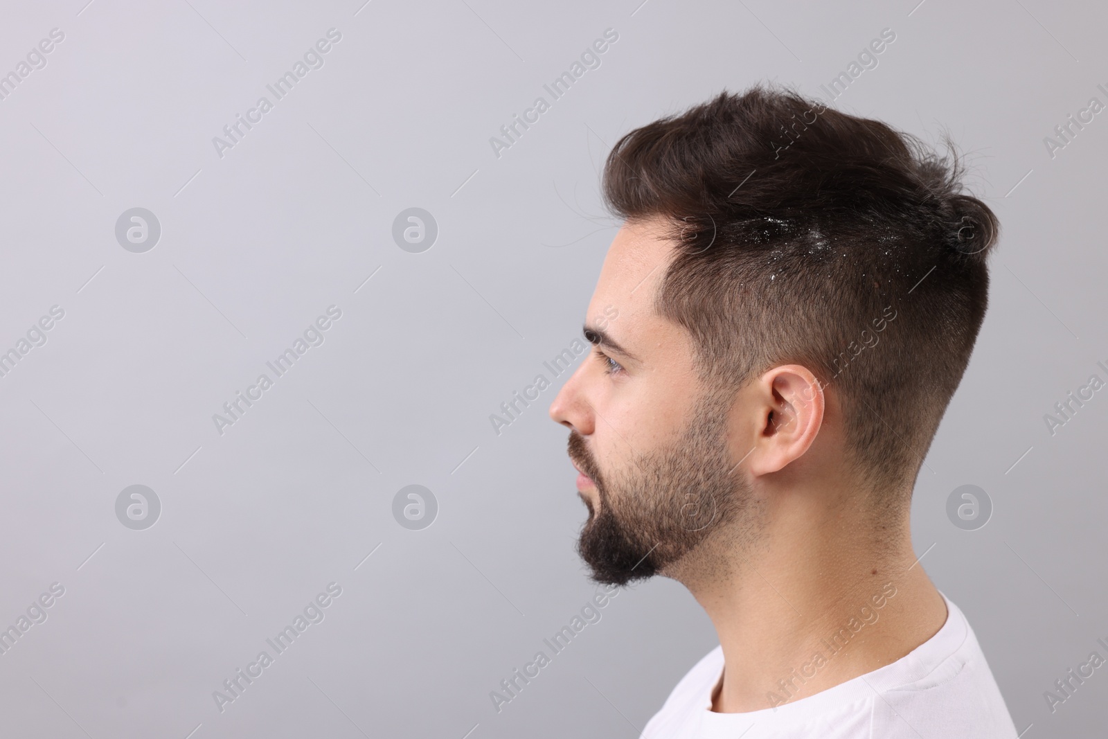 Photo of Man with dandruff in his dark hair on light grey background, space for text