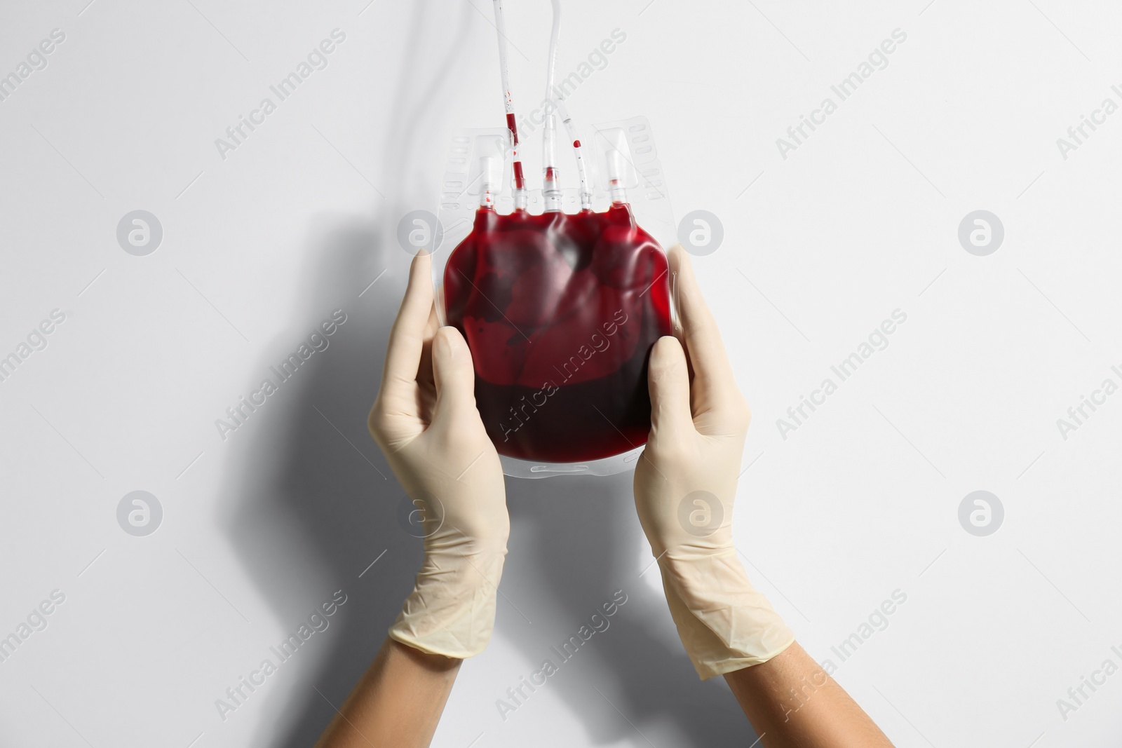 Photo of Woman holding blood for transfusion on light background, closeup. Donation concept