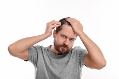 Man with dandruff in his dark hair on white background