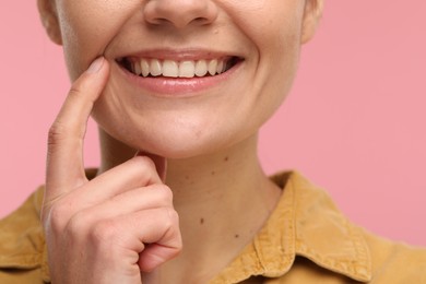 Photo of Woman showing her clean teeth and smiling on pink background, closeup