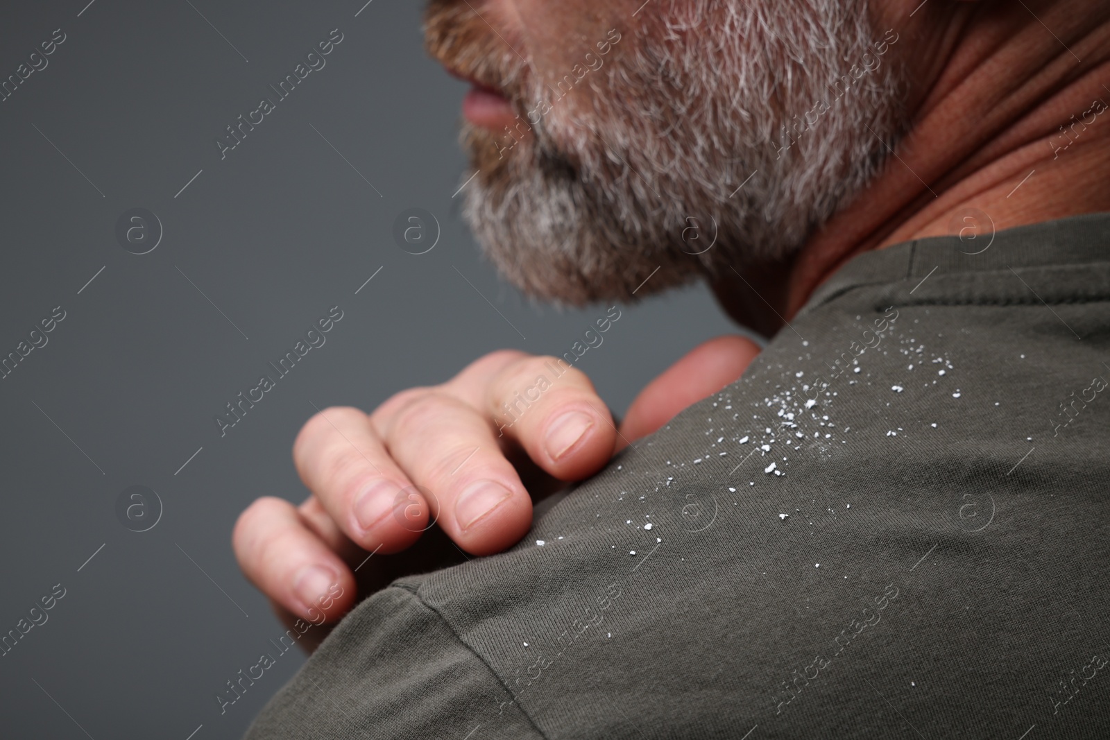 Photo of Bearded man brushing dandruff off his t-shirt on grey background, closeup. Space for text