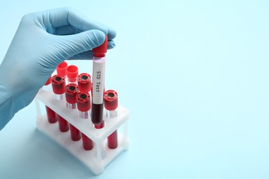 Scientist taking tube with blood sample and label STD Test from rack on light blue background, closeup. Space for text