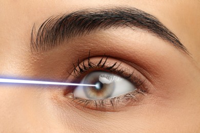 Closeup view of woman and laser ray illustration. Vision correction surgery