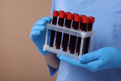 Photo of Laboratory testing. Doctor with blood samples in tubes on light brown background, closeup