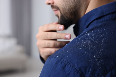 Man brushing dandruff off his shirt indoors, closeup. Space for text