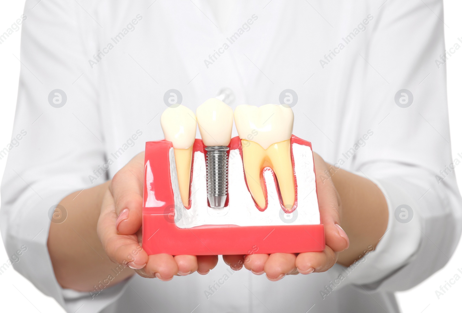 Photo of Dentist holding educational model of dental implant on white background, closeup