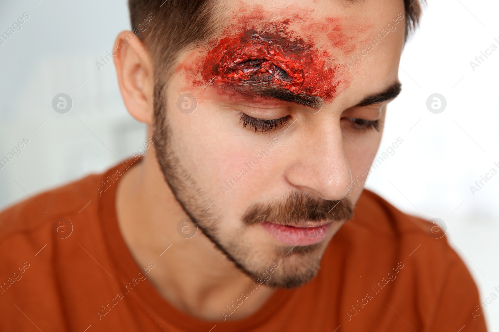 Photo of Young man with head injury in clinic. First aid