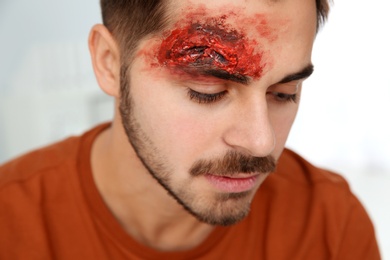 Photo of Young man with head injury in clinic. First aid