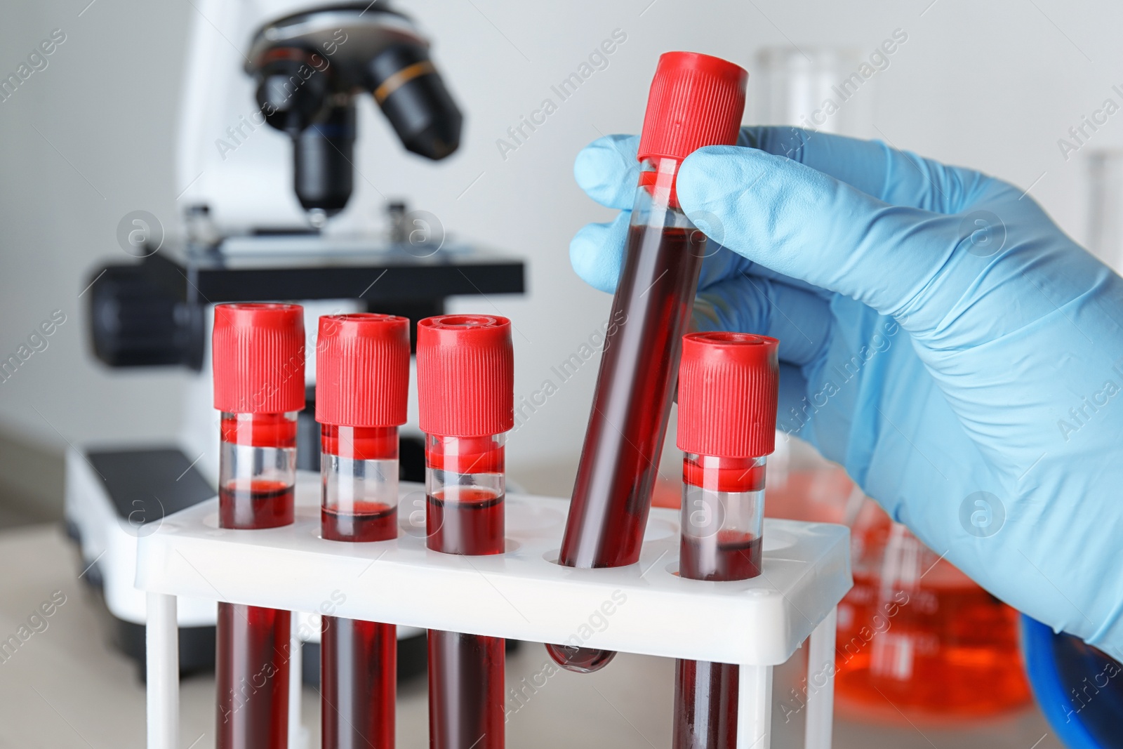 Image of Scientist taking test tube with blood sample from rack at table, closeup. Laboratory analysis