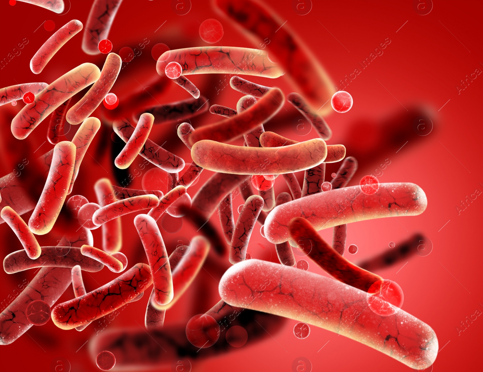 Illustration of Bacteria colony under microscope, illustration. Cystitis, infection of urinary bladder