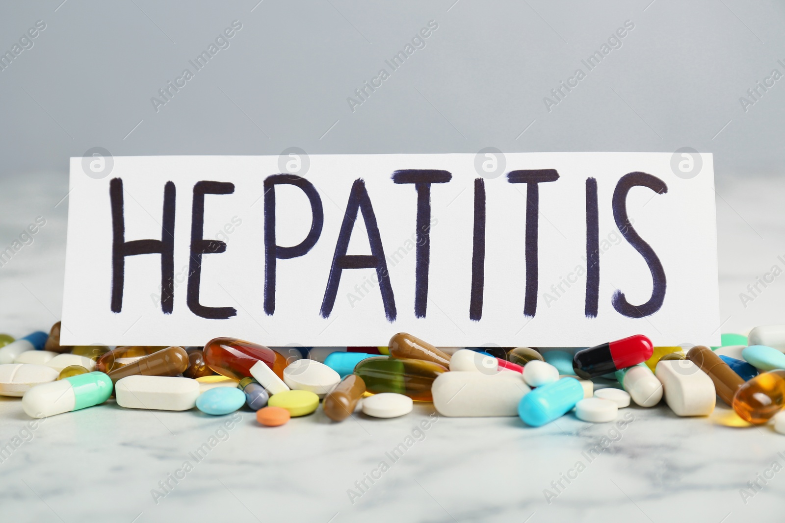 Photo of Word Hepatitis and pills on white marble table