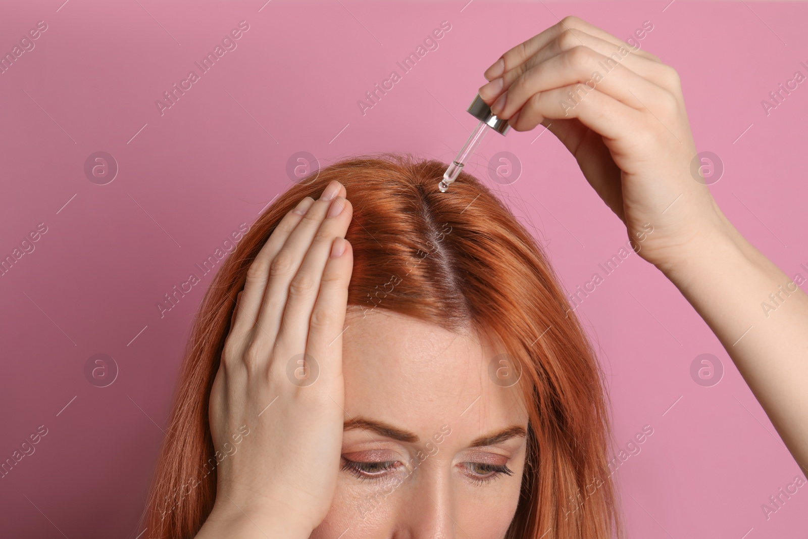 Photo of Woman applying oil onto hair on pink background, closeup. Baldness problem