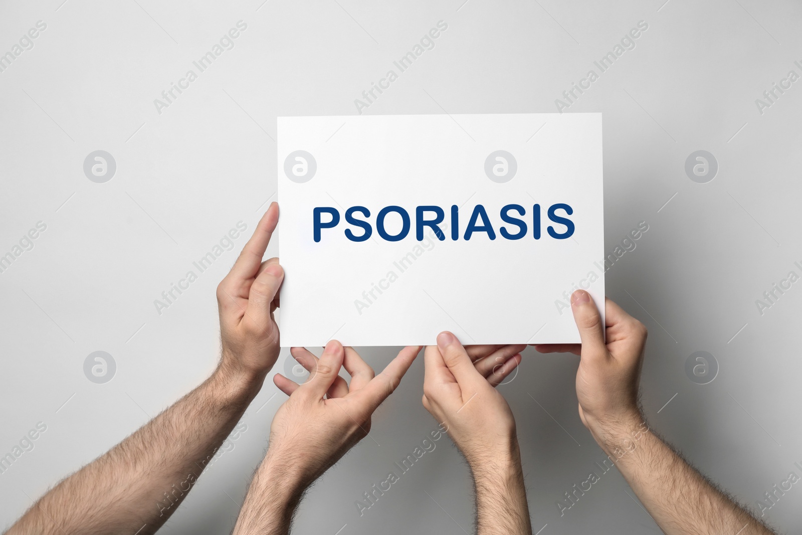 Image of Men holding card with word PSORIASIS on light background, closeup 