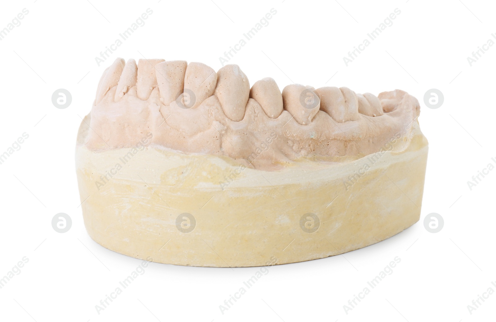 Photo of Dental model with jaw isolated on white. Cast of teeth