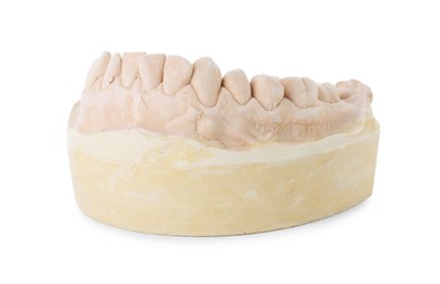 Dental model with jaw isolated on white. Cast of teeth