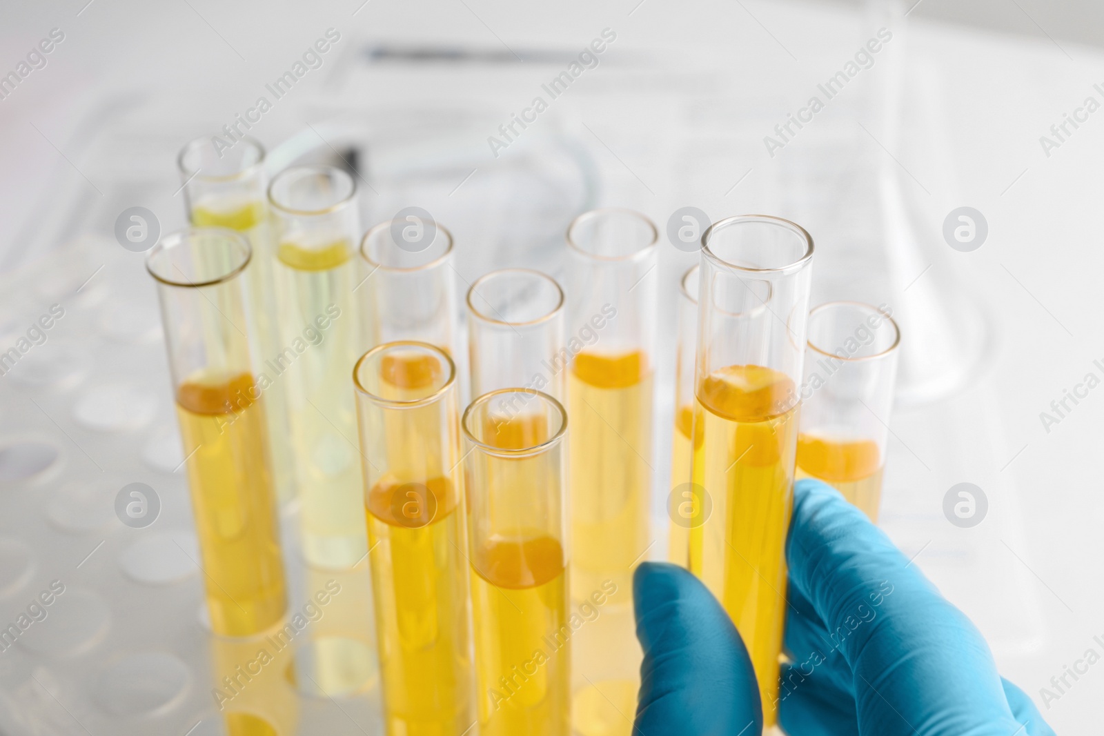 Photo of Nurse holding tube with urine sample, closeup. Specimen collection