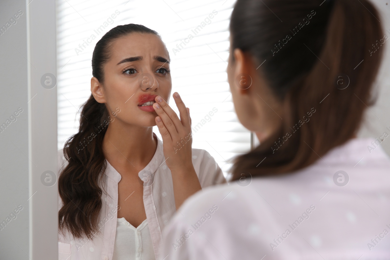 Photo of Young woman with herpes touching lips in front of mirror at home