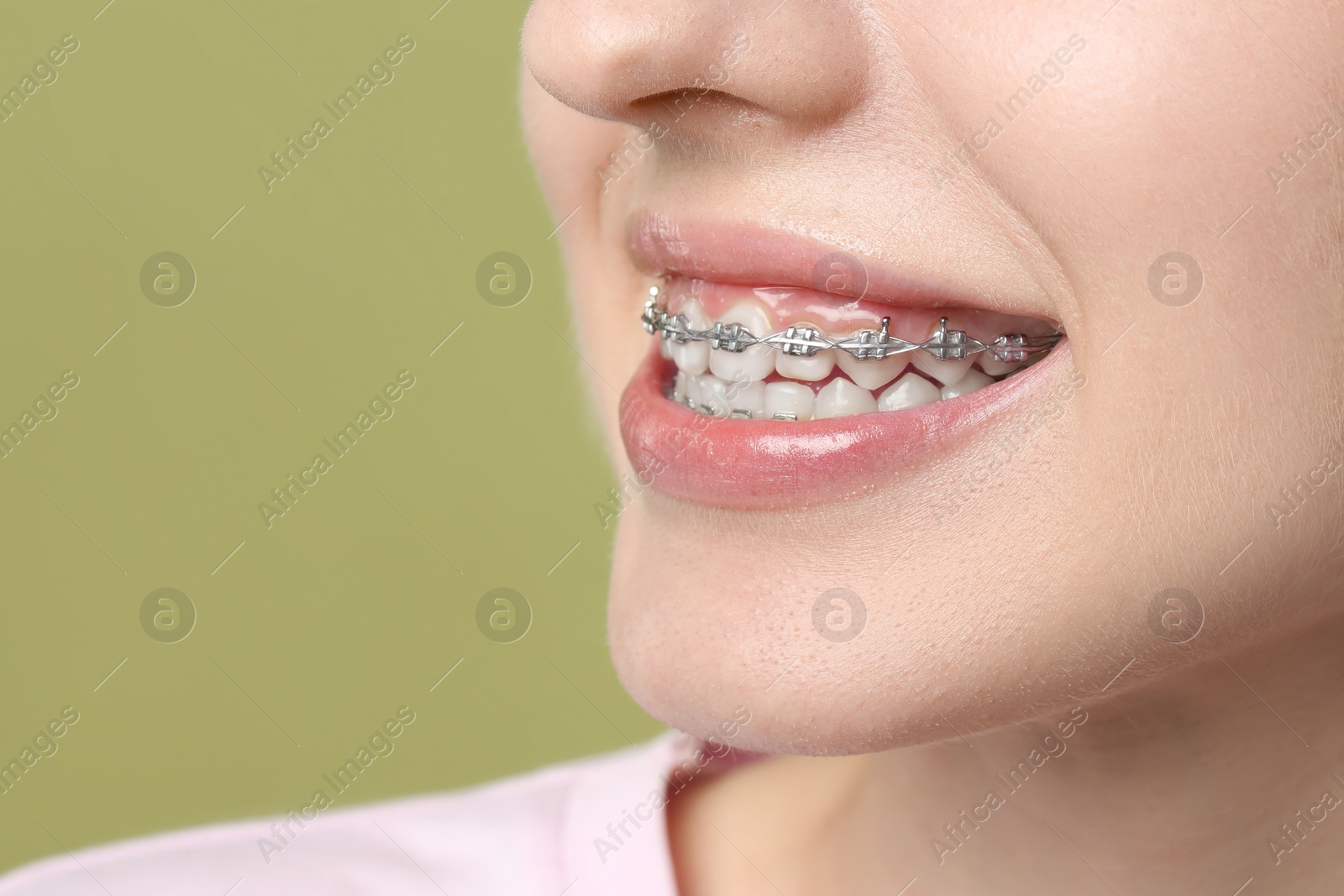 Photo of Smiling woman with dental braces on light green background, closeup. Space for text