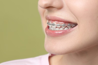 Smiling woman with dental braces on light green background, closeup. Space for text