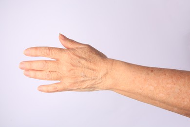 Photo of Closeup view of woman's hand with aging skin on white background