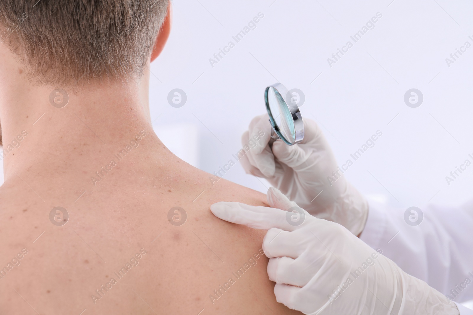 Photo of Dermatologist examining patient with magnifying glass in clinic