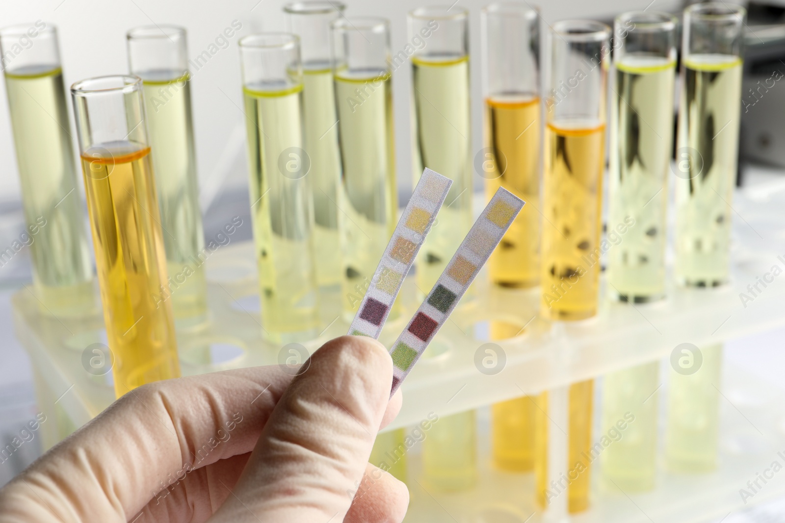 Photo of Nurse holding tube with urine sample for analysis on light grey background, closeup