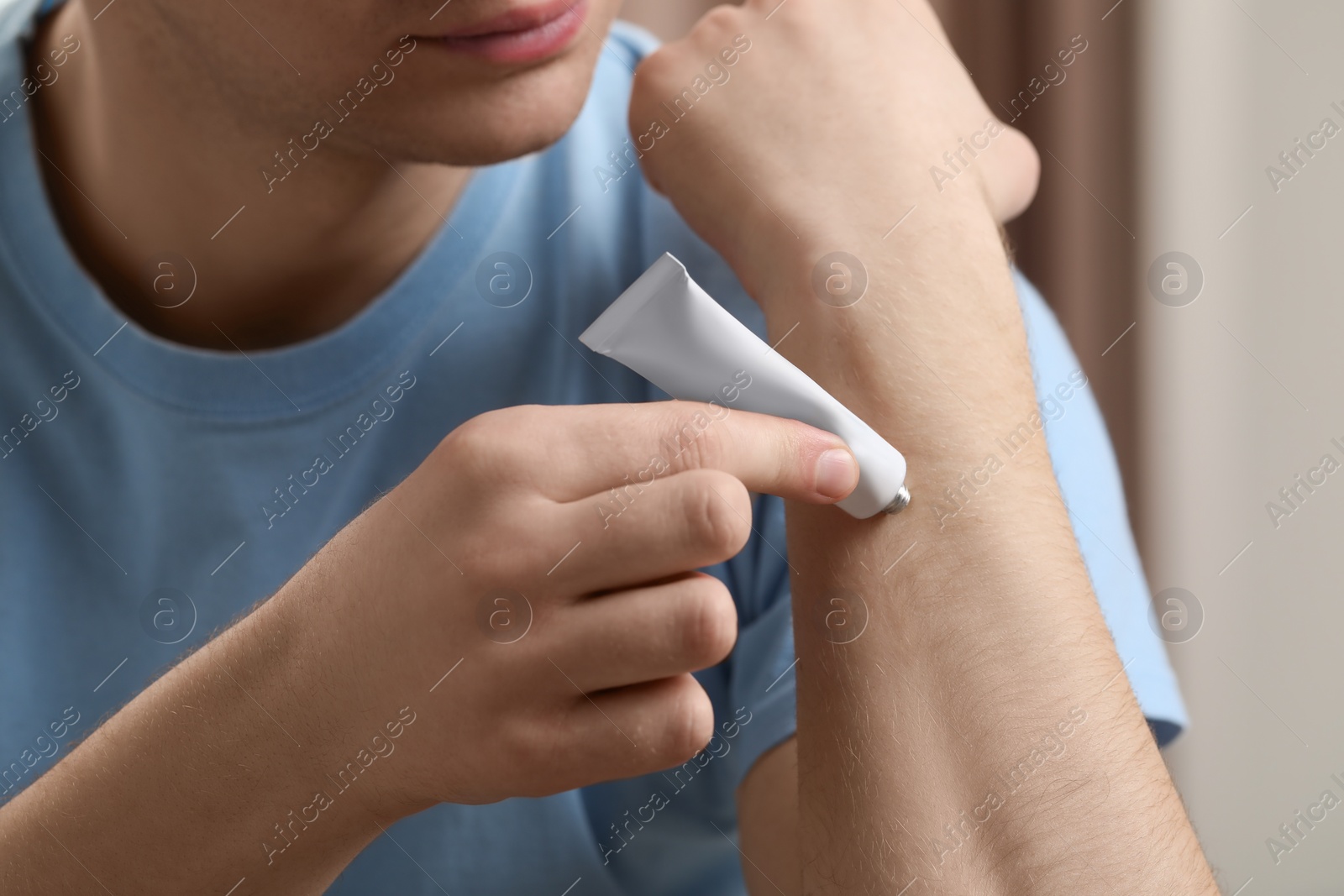 Photo of Man applying ointment from tube onto his arm indoors, closeup