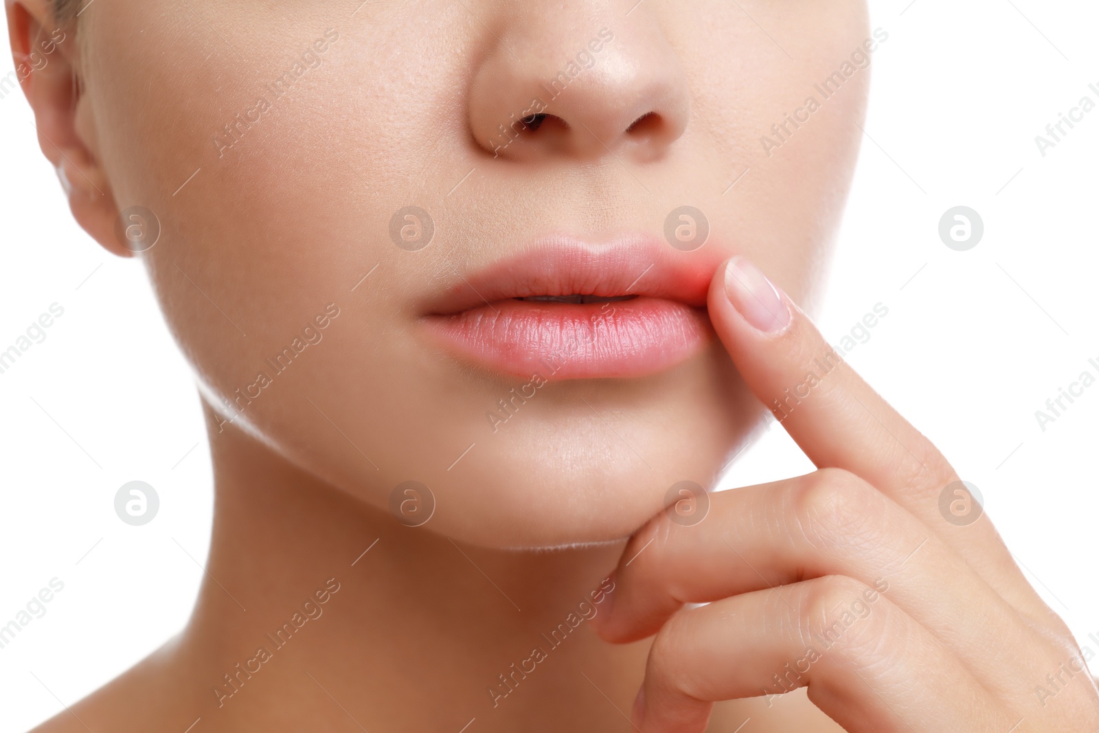 Photo of Young woman with cold sore touching lips against white background, closeup