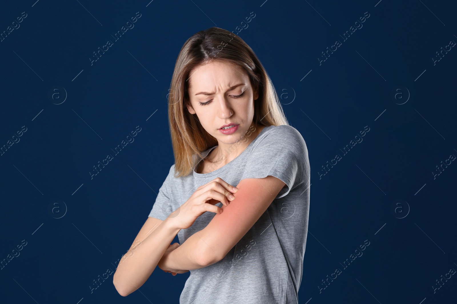 Photo of Portrait of woman scratching arm on color background. Allergy symptom
