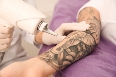 Photo of Young woman undergoing laser tattoo removal procedure in salon, closeup