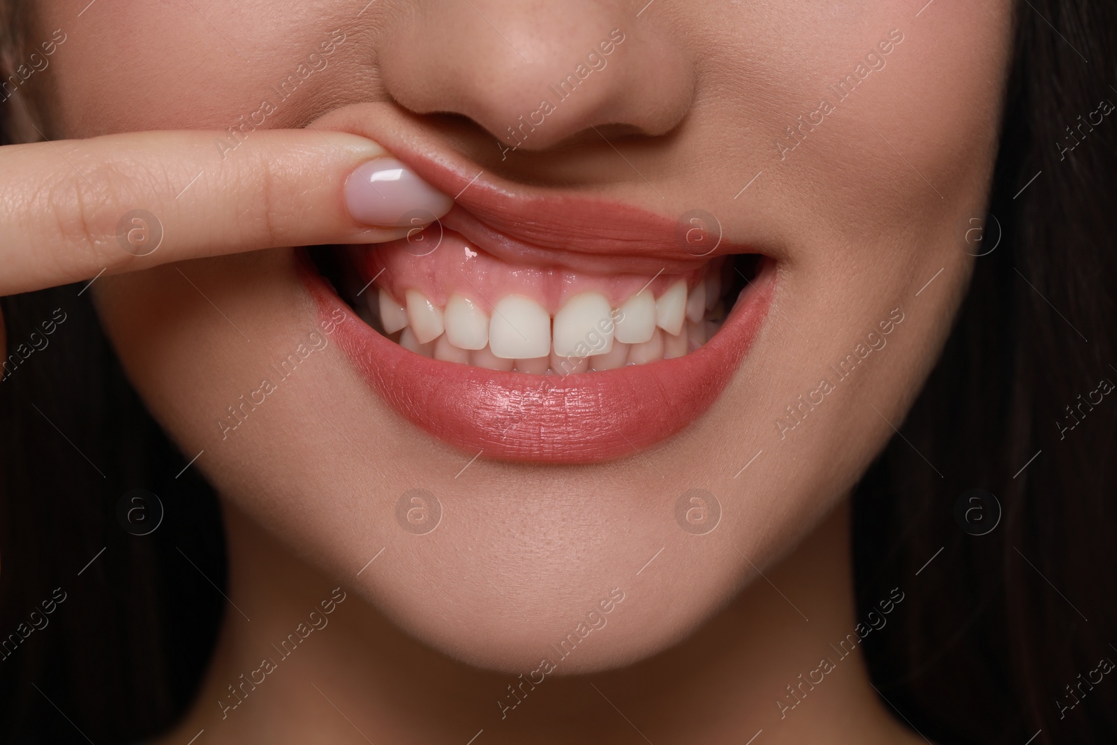 Photo of Young woman showing healthy gums, closeup view