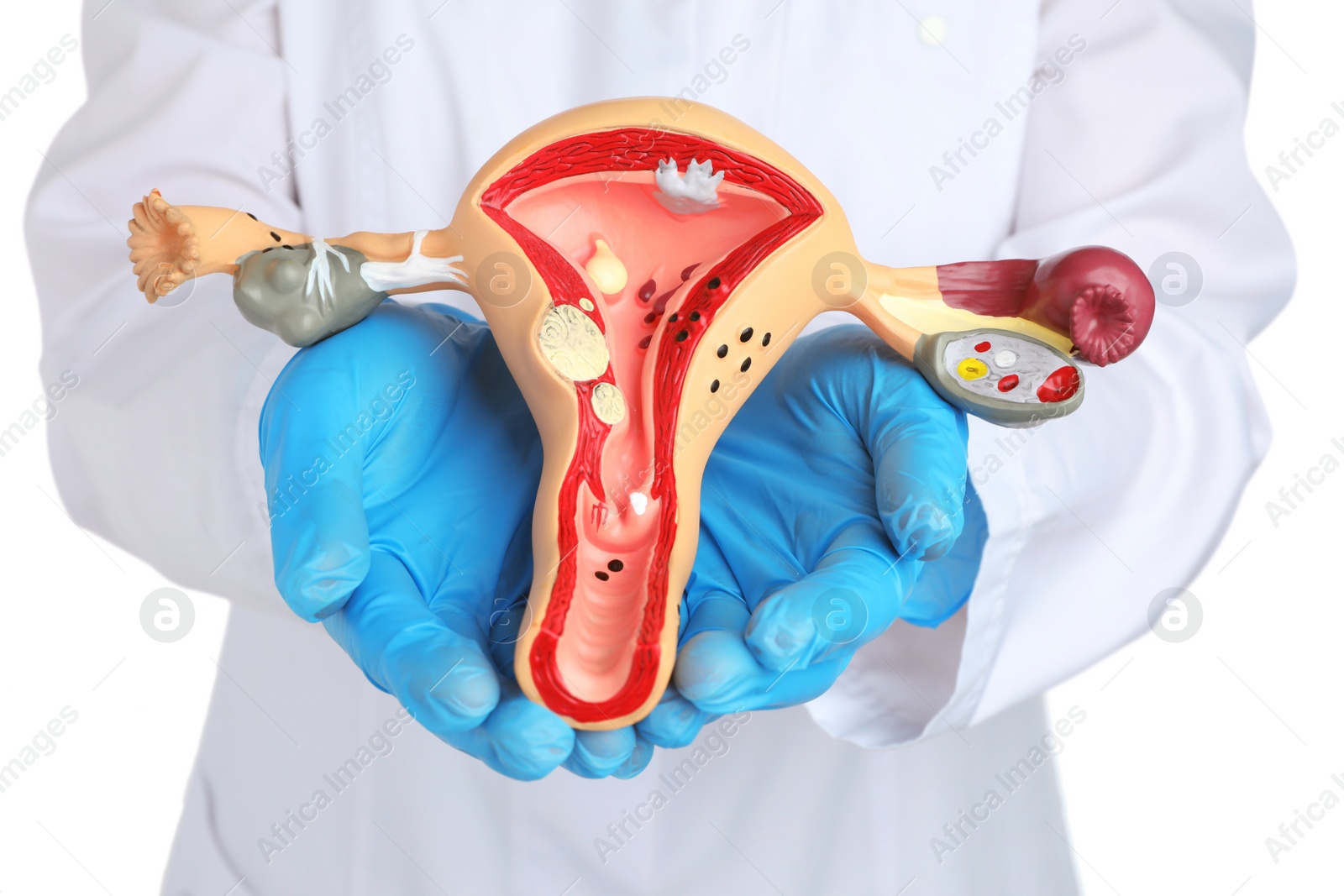 Photo of Gynecologist holding model of female reproductive system on white background, closeup