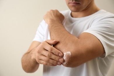 Photo of Man applying cream onto elbow on beige background, closeup