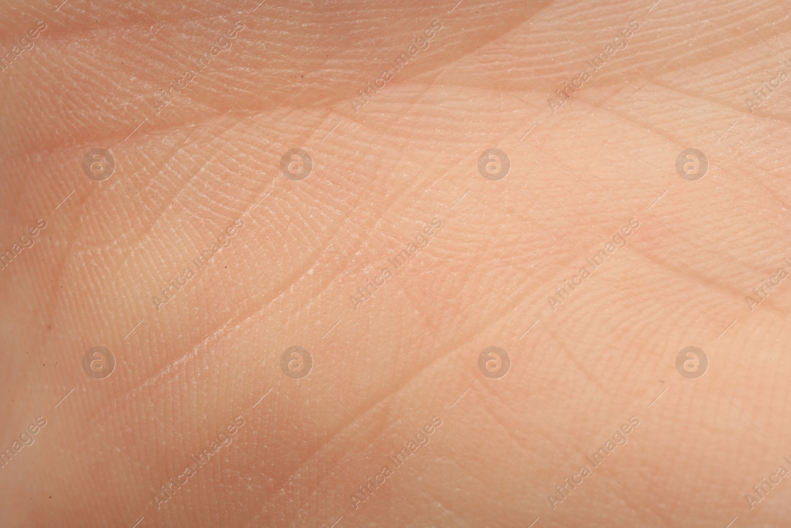 Photo of Texture of dry skin as background, macro view