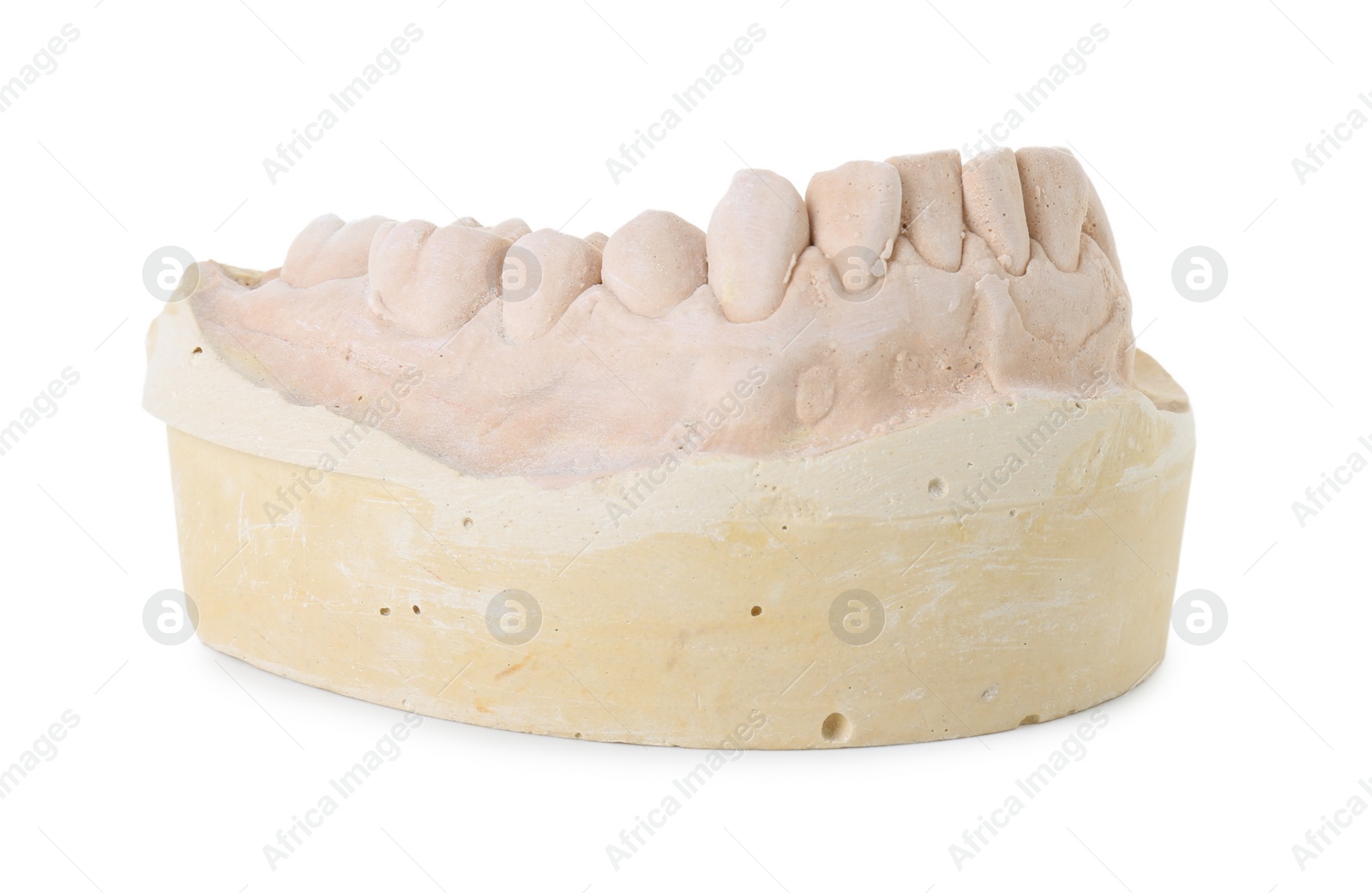 Photo of Dental model with jaw isolated on white. Cast of teeth