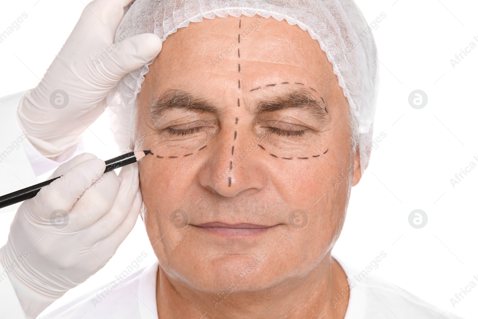 Photo of Doctor marking senior man face before cosmetic surgery on white background