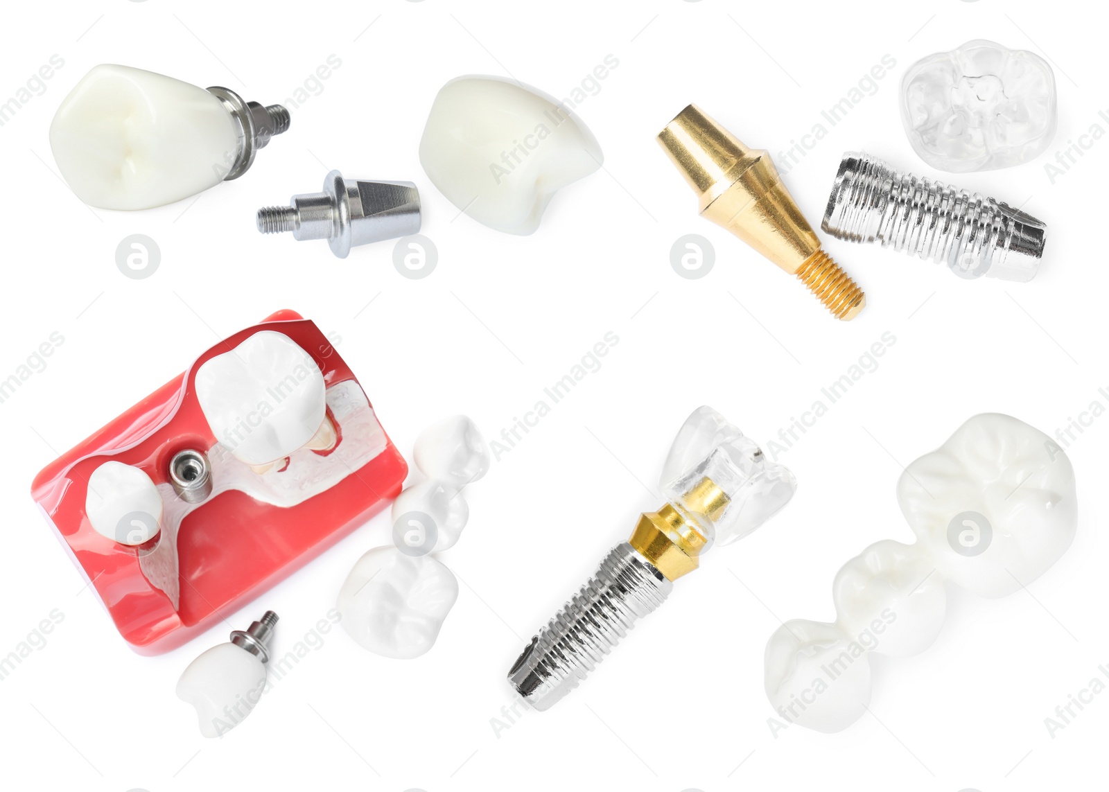 Image of  Educational models of dental implants on white background, top view. Collage