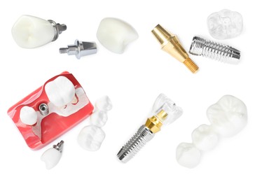 Image of  Educational models of dental implants on white background, top view. Collage