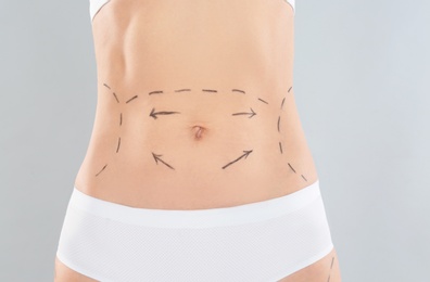 Photo of Woman with marks on body for cosmetic surgery operation against grey background, closeup