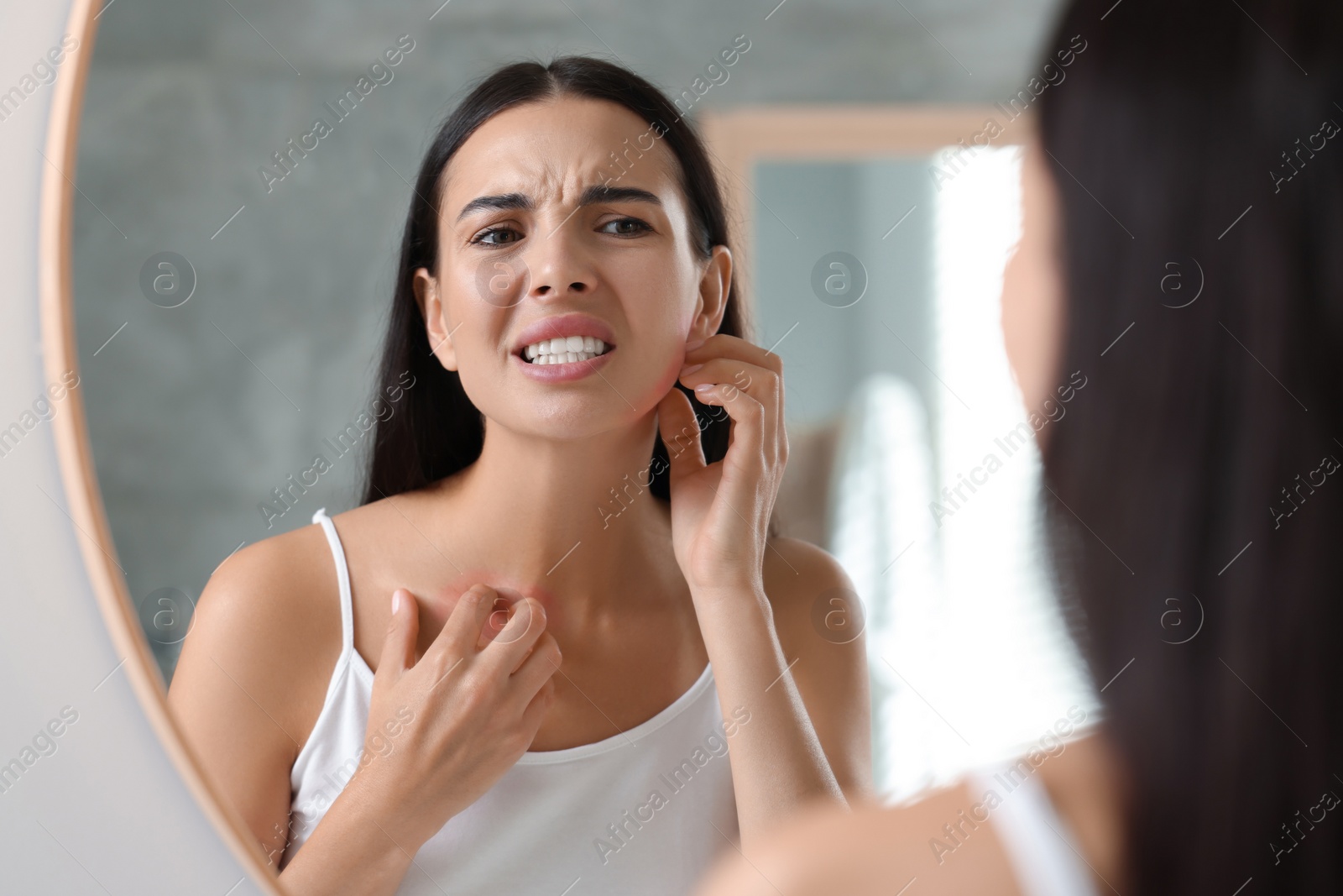 Photo of Suffering from allergy. Young woman scratching her neck near mirror indoors