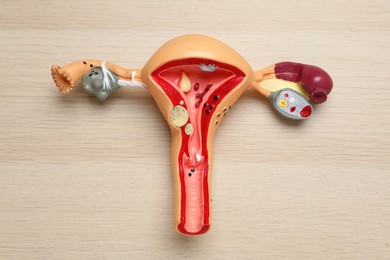 Photo of Anatomical model of uterus on wooden table, top view. Gynecology concept