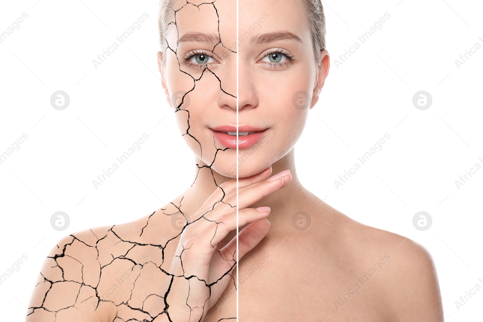 Image of Collage with photos of woman having dry skin problem before and after dry skin problem on white background