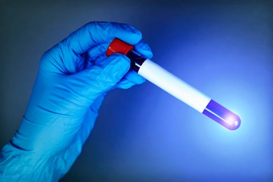 Image of Laboratory worker holding test tube with blood sample, closeup. Color toned