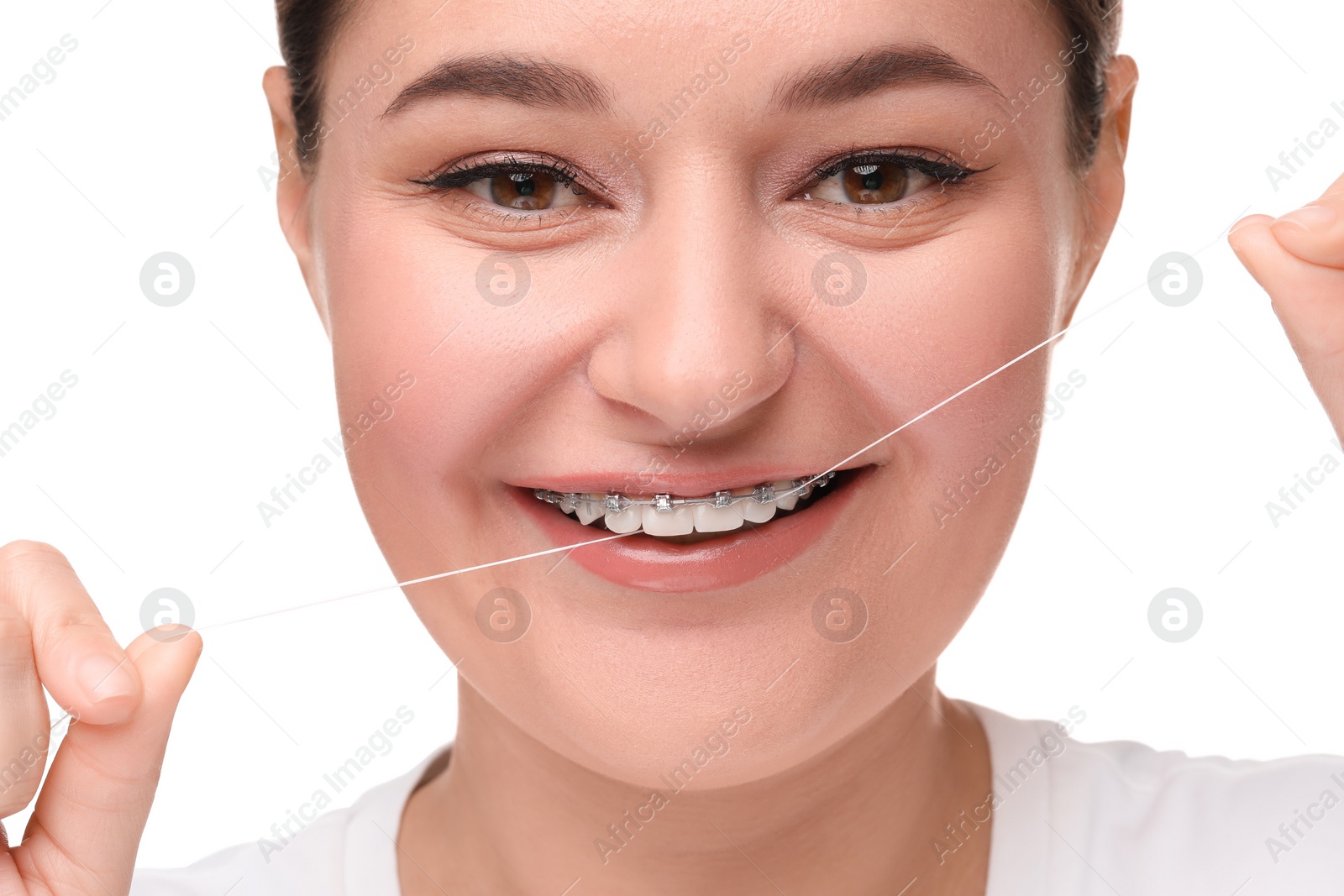 Photo of Smiling woman with braces cleaning teeth using dental floss on white background, closeup